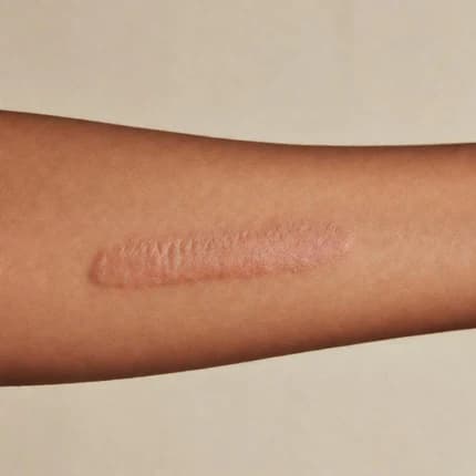 Visible scars affecting your skin confidence